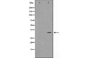 Western blot analysis on HepG2 cell lysate using MAGE-1 Antibody,The lane on the left is treated with the antigen-specific peptide. (MAGEA1 抗体  (C-Term))