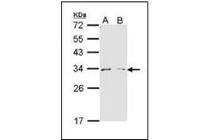 Western Blot analysis using ARG1 antibody at 1/1000 dilution. (Liver Arginase 抗体  (AA 1-145))