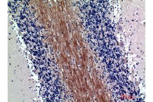 Immunohistochemistry (IHC) analysis of paraffin-embedded Human Brain, antibody was diluted at 1:200. (SIRP-Alpha1/beta1 (Internal Region) 抗体)