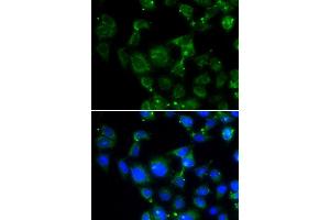 Immunofluorescence analysis of HeLa cell using MAPRE2 antibody. (MAPRE2 抗体)