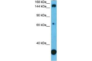 Host:  Rabbit  Target Name:  PLCG1  Sample Type:  PANC1 Whole Cell  Antibody Dilution:  1. (Phospholipase C gamma 1 抗体  (C-Term))