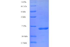 Peptidase Inhibitor 3, Skin-Derived (PI3) (AA 61-117) protein (His-SUMO Tag)