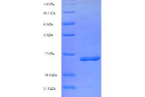 SDS-PAGE (SDS) image for Peptidase Inhibitor 3, Skin-Derived (PI3) (AA 61-117) protein (His-SUMO Tag) (ABIN5710095)
