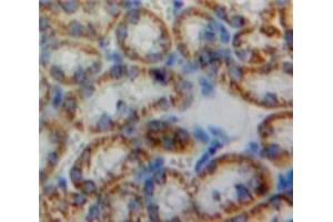 Used in DAB staining on fromalin fixed paraffin-embedded Kidney tissue (HMOX2 抗体  (AA 71-306))