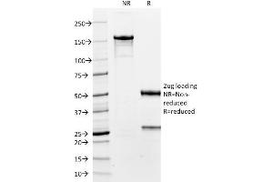 SDS-PAGE Analysis Purified TTF-1 Mouse Monoclonal Antibody (8G7G3/1). (NKX2-1 抗体)