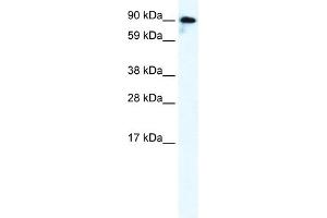 WB Suggested Anti-GRIK2 Antibody Titration:  0. (GRIK2 抗体  (C-Term))