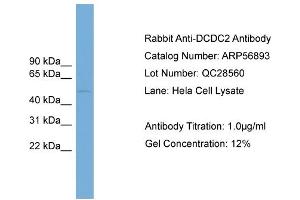 WB Suggested Anti-DCDC2  Antibody Titration: 0. (DCDC2 抗体  (Middle Region))