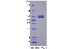Image no. 1 for Solute Carrier Family 25, Member 13 (Citrin) (slc25a13) (AA 326-606) protein (His tag) (ABIN6239637)