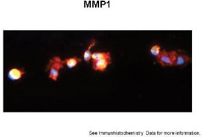 Sample Type: Human Macrophange CellsGreen: primaryRed: phallodinBlue: DAPIYellow: green/redPrimary Dilution: 1:200Secondary Antibody: anti-Rabbit IgG-FITCSecondary Dilution: 1:1000Image Submitted By: Milan FialaUniversity of California, Los Angeles (MMP1 抗体  (C-Term))