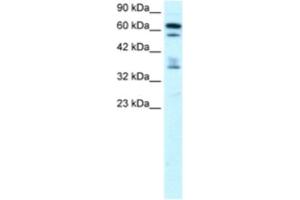 Western Blotting (WB) image for anti-Zinc Finger Protein 512 (ZNF512) antibody (ABIN2460159) (ZNF512 抗体)