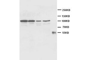 Western Blotting (WB) image for anti-Cadherin 2 (CDH2) antibody (ABIN1105630) (N-Cadherin 抗体)