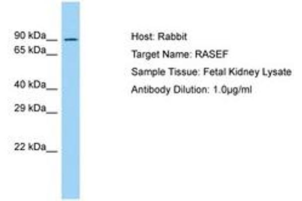 RASEF 抗体  (AA 194-243)