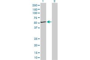 Western Blotting (WB) image for anti-Acyl-CoA Dehydrogenase, C-2 To C-3 Short Chain (Acads) (AA 1-412) antibody (ABIN513055)