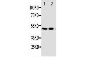 Anti-Vitamin D Receptor antibody, Western blotting Lane 1: MCF-7 Cell Lysate Lane 2: HELA Cell Lysate (Vitamin D Receptor 抗体  (C-Term))