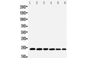 Anti-SNAP23 antibody, Western blotting Lane 1: Rat Spleen Tissue Lysate Lane 2: Rat testis Tissue Lysate Lane 3: Rat Ovary Tissue Lysate Lane 4: HELA Cell Lysate Lane 5: MCF-7 Cell Lysate Lane 6: SKOV Cell Lysate (SNAP23 抗体  (C-Term))