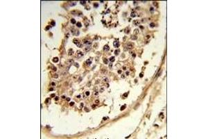 Formalin-fixed and paraffin-embedded human testis tissue reacted with CXCR7 Antibody (C-term), which was peroxidase-conjugated to the secondary antibody, followed by DAB staining. (CXCR7 抗体  (C-Term))