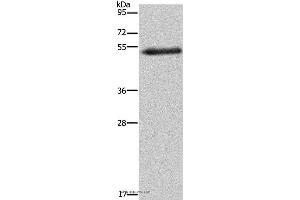 Western blot analysis of Human breast infiltrative duct tissue, using FOXC2 Polyclonal Antibody at dilution of 1:733 (FOXC2 抗体)