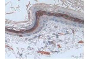 IHC-P analysis of Rat Skin Tissue, with DAB staining. (Involucrin 抗体  (AA 461-551))