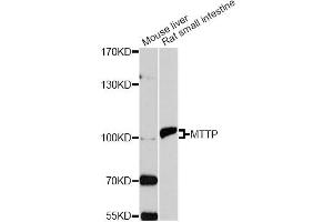 Western blot analysis of extracts of various cell lines, using MTTP antibody.