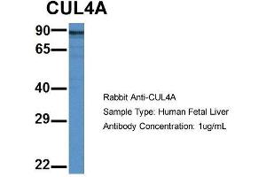 Host: Rabbit  Target Name: CUL4A  Sample Tissue: Human Fetal Liver  Antibody Dilution: 1. (Cullin 4A 抗体  (Middle Region))