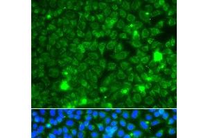 Immunofluorescence analysis of A549 cells using GBA3 Polyclonal Antibody (GBA3 抗体)
