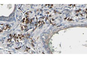 ABIN6277241 at 1/100 staining Human prostate tissue by IHC-P. (HNMT 抗体  (Internal Region))