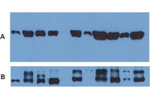 Use of alpha Tubulin monoclonal antibody, clone TU-01  as a loading control (A) in an Western blotting experiment revealing the staining pattern of various cell lysates by a newly developed monoclonal antibody (B). (alpha Tubulin 抗体)