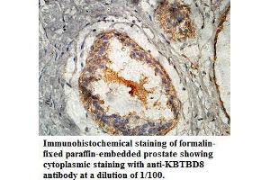 Image no. 1 for anti-Kelch Repeat and BTB (POZ) Domain Containing 8 (KBTBD8) antibody (ABIN1577436) (KBTBD8 抗体)