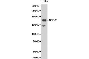 Western Blotting (WB) image for anti-Nuclear Receptor Coactivator 1 (NCOA1) (AA 1222-1441) antibody (ABIN3021492) (NCOA1 抗体  (AA 1222-1441))