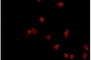 ABIN6269400 staining HeLa cells by IF/ICC. (HDAC6 抗体  (N-Term))