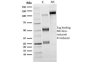 SDS-PAGE Analysis Purified OLIG2 Mouse Monoclonal Antibody (OLIG2/2400). (OLIG2 抗体  (AA 1-141))