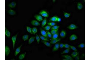 Immunofluorescence staining of A549 cells with ABIN7159070 at 1:100, counter-stained with DAPI. (MMP28 抗体  (AA 351-475))