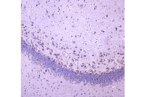 Immunohistochemistry (IHC) image for anti-WW Domain Containing Oxidoreductase (WWOX) (AA 1-245) antibody (ABIN5693294)