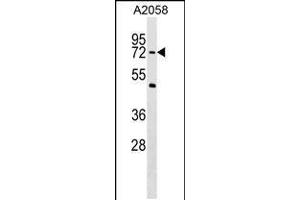 Western blot analysis in A2058 cell line lysates (35ug/lane). (PHF19 抗体  (C-Term))