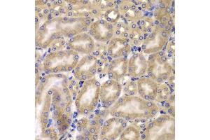 Immunohistochemistry of paraffin-embedded mouse kidney using C antibody (ABIN6127549, ABIN6137937, ABIN6137938 and ABIN6223226) at dilution of 1:100 (40x lens). (CARD10 抗体  (AA 863-1032))
