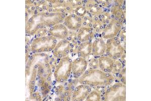 Immunohistochemistry of paraffin-embedded mouse kidney using C antibody (ABIN6127549, ABIN6137937, ABIN6137938 and ABIN6223226) at dilution of 1:100 (40x lens). (CARD10 抗体  (AA 863-1032))