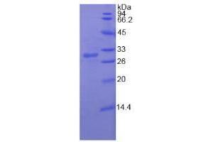 SDS-PAGE analysis of Human RIG1 Protein. (DDX58 蛋白)