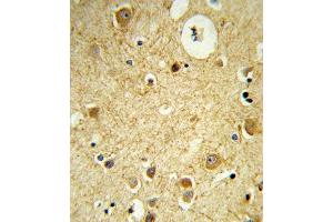 Formalin-fixed and paraffin-embedded human brain tissue reacted with RECK Antibody (Center), which was peroxidase-conjugated to the secondary antibody, followed by DAB staining. (RECK 抗体  (AA 430-456))
