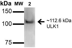 Western blot analysis of Human HeLa and 293Trap cell lysates showing detection of 112. (ULK1 抗体  (AA 567-577) (APC))