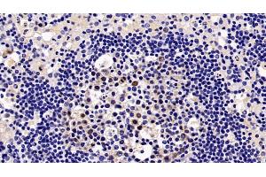 Immunohistochemistry (IHC) image for anti-Karyopherin alpha 2 (RAG Cohort 1, Importin alpha 1) (KPNA2) (AA 157-412) antibody (ABIN7435853)