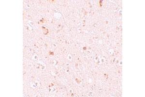 Immunohistochemical staining of human brain cells with SH3RF2 polyclonal antibody  at 10 ug/mL. (SH3RF2 抗体  (C-Term))