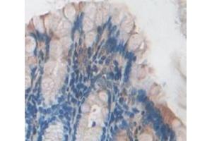 IHC-P analysis of Mouse Tissue, with DAB staining. (ITPA 抗体  (AA 2-198))