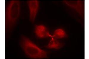 Image no. 2 for anti-Spleen tyrosine Kinase (SYK) (AA 321-325) antibody (ABIN319415)
