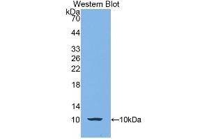 Detection of Recombinant CALY, Human using Polyclonal Antibody to Calcyon Neuron Specific Vesicular Protein (CALY) (CALY 抗体  (AA 1-63))