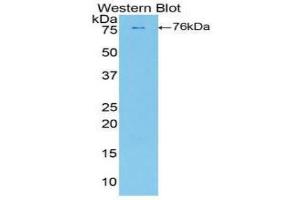 Western blot analysis of the recombinant protein. (PLAA 抗体  (AA 534-792))