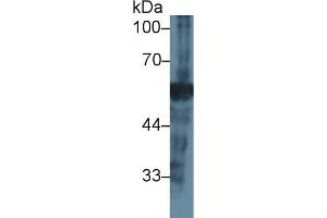 Detection of NEU in Mouse Pancreas lysate using Polyclonal Antibody to Neuraminidase (NEU) (NEU1 抗体  (AA 47-415))