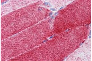 Human Skeletal muscle: Formalin-Fixed, Paraffin-Embedded (FFPE) (COX6B1 抗体  (AA 1-87))