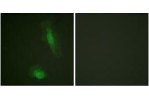 Immunofluorescence analysis of HeLa cells, using Akt (Ab-129) Antibody. (AKT1 抗体  (AA 95-144))