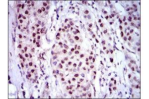 Immunohistochemistry (IHC) image for anti-Napsin A Aspartic Peptidase (NAPSA) (AA 20-158) antibody (ABIN1845258)