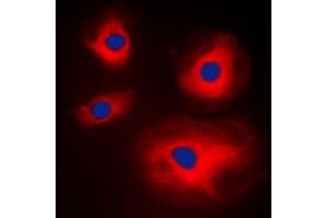 Immunofluorescent analysis of MRPL11 staining in A431 cells. (MRPL11 抗体  (Center))